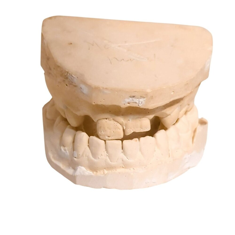 Vintage Dental Cast Plaster Teeth Model Upper Lower Jaw Teaching Aid Oddity